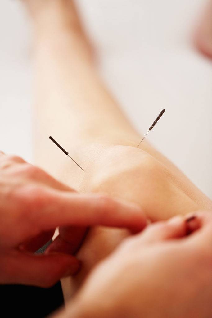 Acupuncture treatment on knee